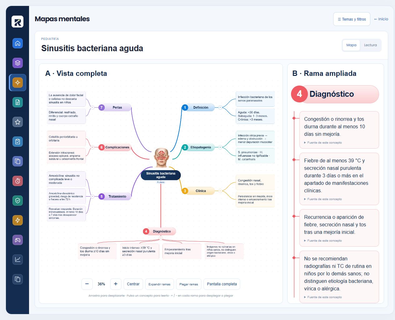 Mapa mental real de Sinusitis bacteriana aguda con su rama de diagnóstico ampliada